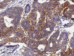 Invitrogen A33 Recombinant Rabbit Monoclonal Antibody (071) 100 &mu;L;