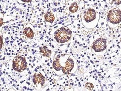 Invitrogen A33 Recombinant Rabbit Monoclonal Antibody (071) 100 &mu;L;