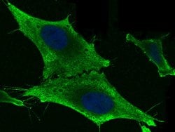 Invitrogen GSTM2 Recombinant Rabbit Monoclonal Antibody (006) 100 &mu;L;