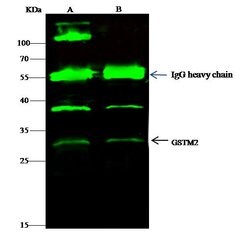 Invitrogen GSTM2 Recombinant Rabbit Monoclonal Antibody (006) 100 &mu;L;