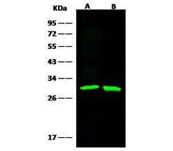 Invitrogen GSTM2 Recombinant Rabbit Monoclonal Antibody (006) 100 &mu;L;