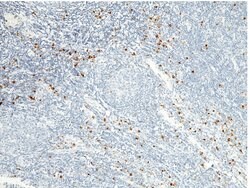 Granzyme B Recombinant Rabbit Monoclonal Antibody (2):Antibodies, Recombinant