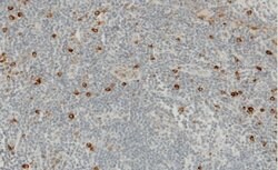 Granzyme B Recombinant Rabbit Monoclonal Antibody (2):Antibodies, Recombinant