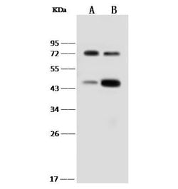 Invitrogen IL18RAP Recombinant Rabbit Monoclonal Antibody (290) 100 &mu;L;