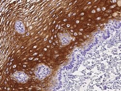 Invitrogen IL1F9 Recombinant Rabbit Monoclonal Antibody (013) 100 &mu;L;