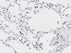 Invitrogen IL1F9 Recombinant Rabbit Monoclonal Antibody (013) 100 &mu;L;