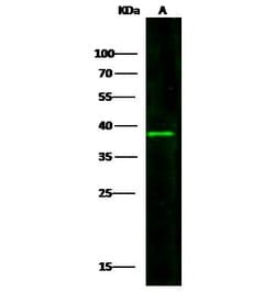 Invitrogen CD123 Recombinant Rabbit Monoclonal Antibody (017) 100 &mu;L;