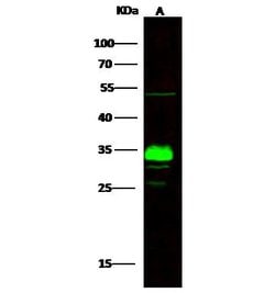 Invitrogen ING5 Recombinant Rabbit Monoclonal Antibody (119) 100 &mu;L;