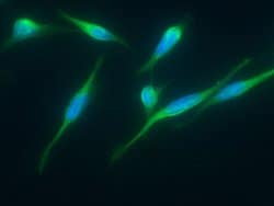Invitrogen ITCH Monoclonal Antibody (01) 100 &mu;L; Unconjugated:Antibodies,