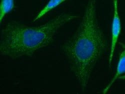 Invitrogen IVD Monoclonal Antibody (04) 100 &mu;L; Unconjugated:Antibodies,