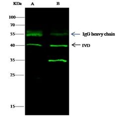 Invitrogen IVD Monoclonal Antibody (04) 100 &mu;L; Unconjugated:Antibodies,