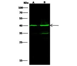 Invitrogen IVD Monoclonal Antibody (04) 100 &mu;L; Unconjugated:Antibodies,