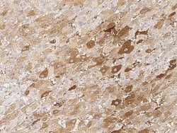 Invitrogen KChIP3 Recombinant Rabbit Monoclonal Antibody (038) 100 &mu;L;