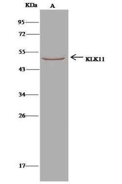 Invitrogen Kallikrein 11 Recombinant Rabbit Monoclonal Antibody (121) 100
