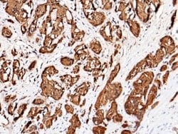 Invitrogen PSA Monoclonal Antibody (03) 100 &mu;L; Unconjugated:Antibodies,