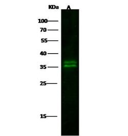 Invitrogen Kallikrein 8 Recombinant Rabbit Monoclonal Antibody (140) 100