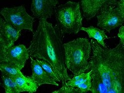 Invitrogen KYNU Recombinant Rabbit Monoclonal Antibody (062) 100 &mu;L;