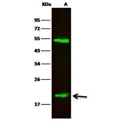 Invitrogen NGAL Recombinant Rabbit Monoclonal Antibody (128) 100 &mu;L;