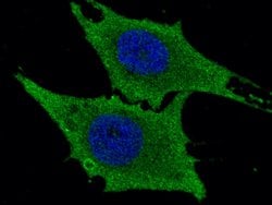Invitrogen LTA4H Recombinant Rabbit Monoclonal Antibody (201) 100 &mu;L | Buy Online | Invitrogen&trade; | Fisher Scientific