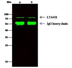 Invitrogen LTA4H Recombinant Rabbit Monoclonal Antibody (201) 100 &mu;L | Buy Online | Invitrogen&trade; | Fisher Scientific