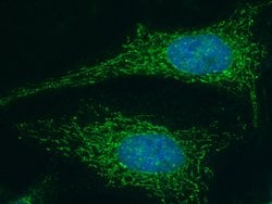 Invitrogen LUM Recombinant Rabbit Monoclonal Antibody (077) 100 &mu;L | Buy Online | Invitrogen&trade; | Fisher Scientific