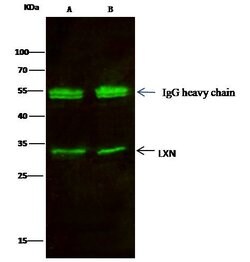 Invitrogen Latexin Recombinant Rabbit Monoclonal Antibody (101) 100 &mu;L;