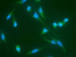 Invitrogen JNK2 Recombinant Rabbit Monoclonal Antibody (011) 100 &mu;L;