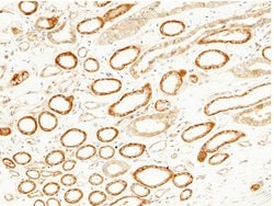 Invitrogen JNK2 Recombinant Rabbit Monoclonal Antibody (011) 100 &mu;L;