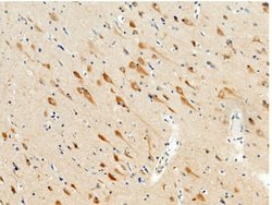 Invitrogen JNK2 Recombinant Rabbit Monoclonal Antibody (011) 100 &mu;L;
