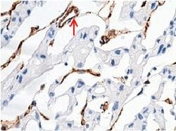 Invitrogen CD146 Recombinant Rabbit Monoclonal Antibody (012) 100 &mu;L;