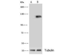 Invitrogen CD146 Recombinant Rabbit Monoclonal Antibody (012) 100 &mu;L;