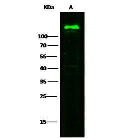 Invitrogen CD146 Recombinant Rabbit Monoclonal Antibody (012) 100 &mu;L;