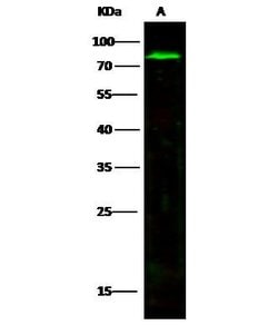 Invitrogen MMP2 Recombinant Rabbit Monoclonal Antibody (026) 100 &mu;L;