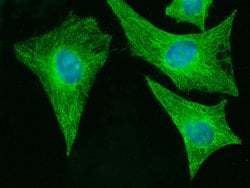 Invitrogen MOB4A Monoclonal Antibody (01) 100 &mu;L; Unconjugated:Antibodies,