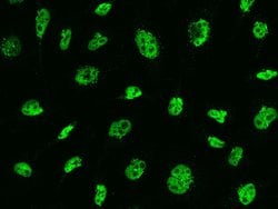 Invitrogen MSH6 Recombinant Rabbit Monoclonal Antibody (021) 100 &mu;L;