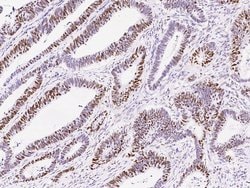 Invitrogen MSH6 Recombinant Rabbit Monoclonal Antibody (021) 100 &mu;L;