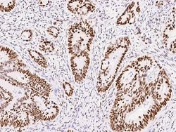 Invitrogen MSH6 Recombinant Rabbit Monoclonal Antibody (021) 100 &mu;L;
