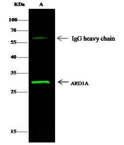 Invitrogen ARD1A Monoclonal Antibody (10) 100 &mu;L; Unconjugated:Antibodies,