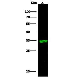 Invitrogen ARD1A Monoclonal Antibody (10) 100 &mu;L; Unconjugated:Antibodies,