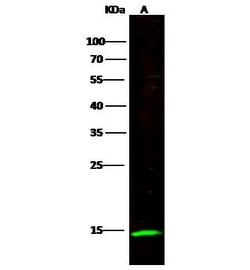 Invitrogen NKp30 Recombinant Rabbit Monoclonal Antibody (012) 100 &mu;L | Buy Online | Invitrogen&trade; | Fisher Scientific