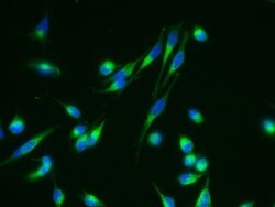 Invitrogen Nicastrin Recombinant Rabbit Monoclonal Antibody (004) 100 &mu;L;