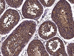 Invitrogen Nectin 3 Monoclonal Antibody (02) 100 &mu;L; Unconjugated:Antibodies,