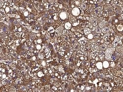 Invitrogen Nectin 3 Monoclonal Antibody (02) 100 &mu;L; Unconjugated:Antibodies,