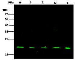 Invitrogen NME1 Recombinant Rabbit Monoclonal Antibody (011) 100 &mu;L | Buy Online | Invitrogen&trade; | Fisher Scientific
