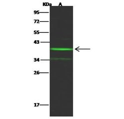 Invitrogen NT5C3A Recombinant Rabbit Monoclonal Antibody (009) 100 &mu;L;