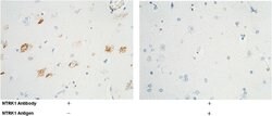 Invitrogen TrkA Recombinant Rabbit Monoclonal Antibody (024) 100 &mu;L;