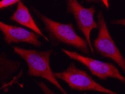DJ-1 Recombinant Rabbit Monoclonal Antibody (007), Invitrogen 100 &mu;L;