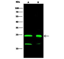 DJ-1 Recombinant Rabbit Monoclonal Antibody (007), Invitrogen 100 &mu;L;