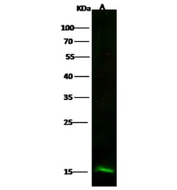 Invitrogen Profilin 2 Recombinant Rabbit Monoclonal Antibody (010) 100