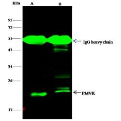 PMVK Recombinant Rabbit Monoclonal Antibody (014) 100 &mu;L | Buy Online | Thermo Scientific | Fisher Scientific